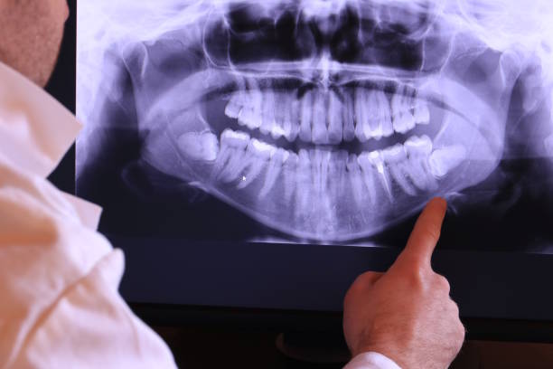 Best Emergency Root Canal Therapy in Banks, OR